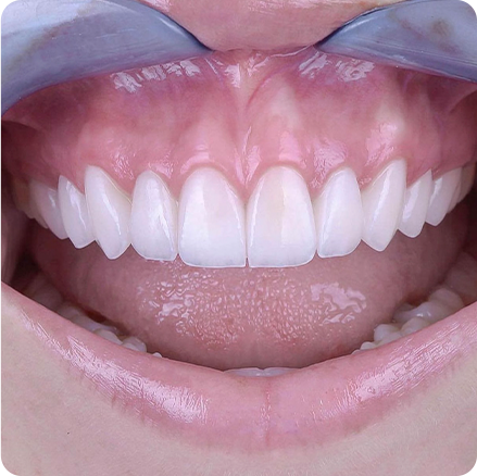 foto-01