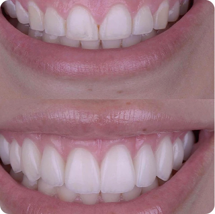 foto-05